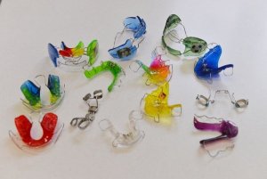 gyermekfogaszat-fogszabalyozas